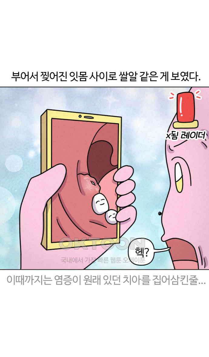 쌉초의 난 41화 사랑니 4